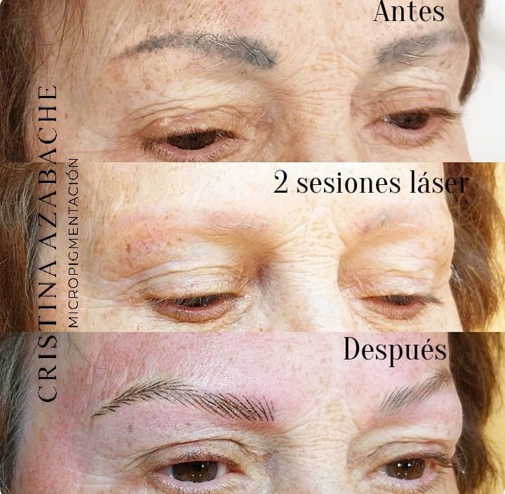 micropigmentacion cejas logroño, micropigmentacion cejas la rioja, micropigmentación logroño, micropigmentación la rioja, Azabache Belleza Logroño, microblading cejas Logroño ,microblading cejas la rioja, microblade cejas Logroño, microblade cejas la rioja, , tatuar cejas logroño, tatuar cejas la rioja