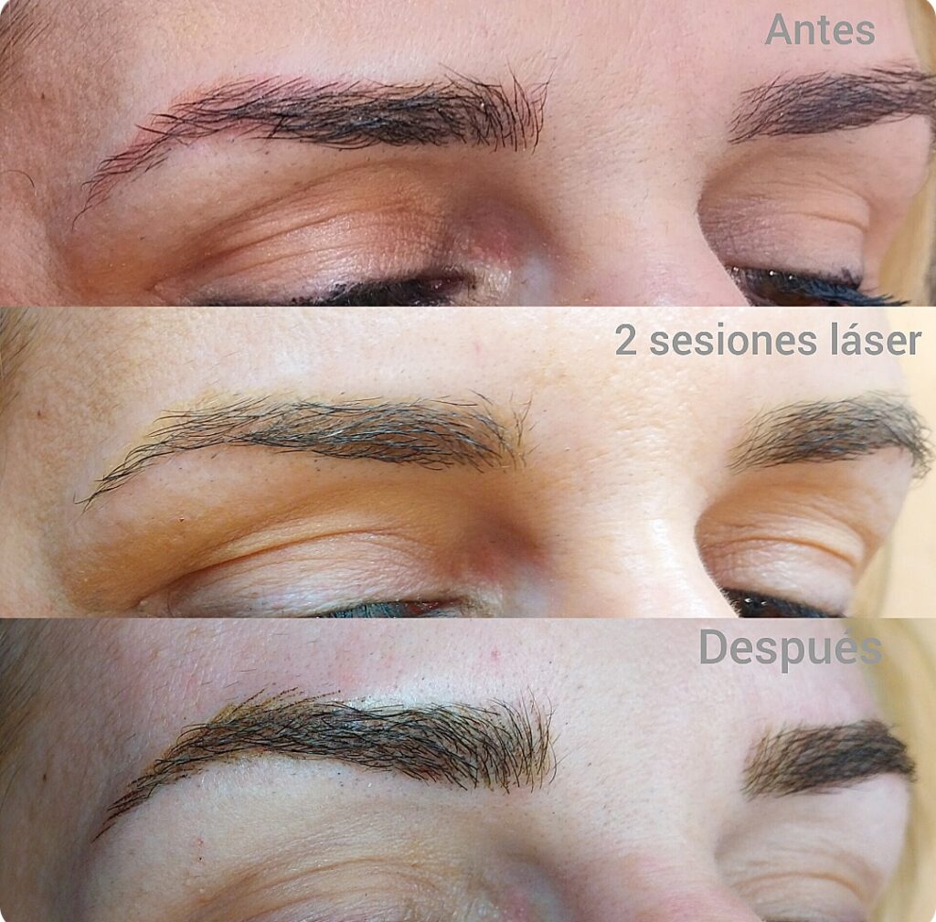 micropigmentacion cejas logroño, micropigmentacion cejas la rioja, micropigmentación logroño, micropigmentación la rioja, Azabache Belleza Logroño, microblading cejas Logroño ,microblading cejas la rioja, microblade cejas Logroño, microblade cejas la rioja, , tatuar cejas logroño, tatuar cejas la rioja