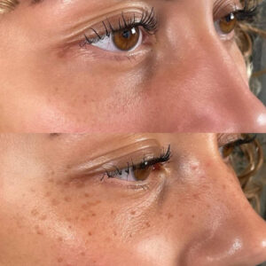 micropigmentacion pecas Logroño, microblading, Azabache belleza logroño, micropigmentación logroño, micropigmentación la rioja, micropigmentacion labios Logroño, micropigmentacion cejas logroño, micropigmentacion cejas la rioja, micropigmentacion capilar Logroño, micropigmentacion capilar la rioja, micropigmentación capilar mujeres Logroño, micropigmentacion eyeliner Logroño, micropigmentacion ojos Logroño, micropigmentacion ojos larioja, pigmentación de labios logroño